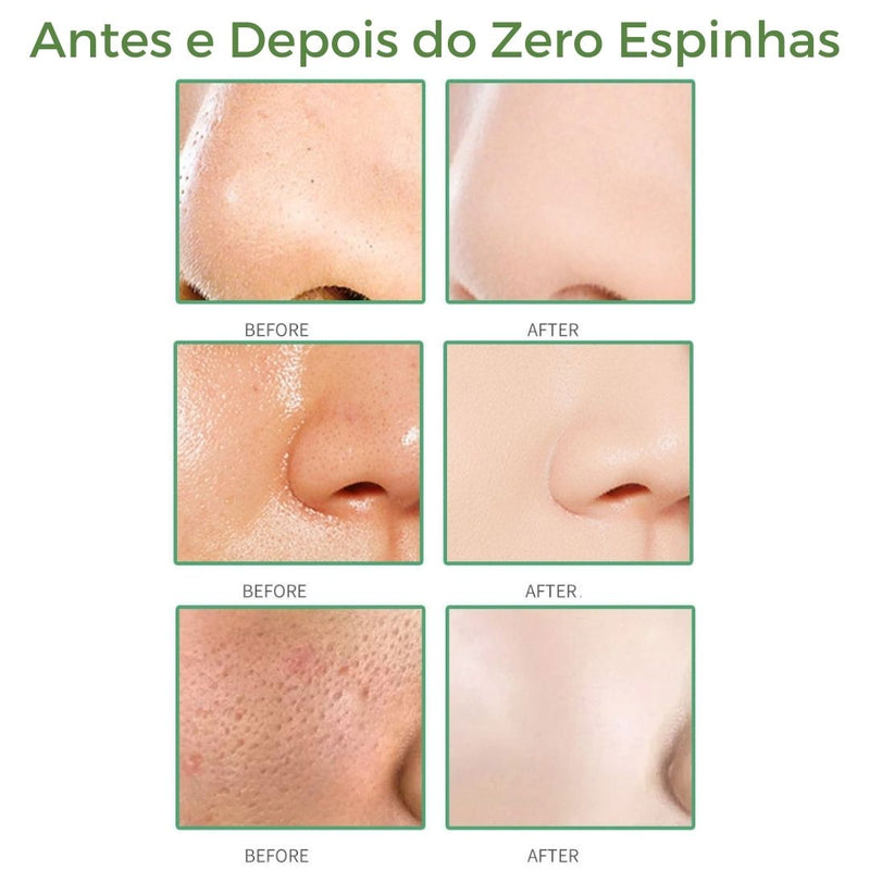 Zero Espinha - Green Mask Stick