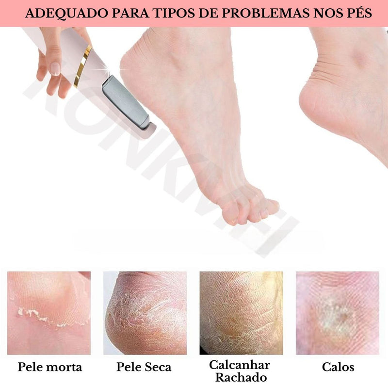 Princess Foot Exfoliator